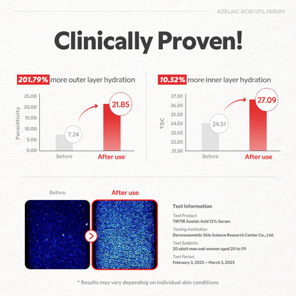 Azelaic Acid 12% Serum